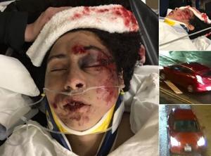 5c66beeaa73a1.image_ | Fox 11 Tri Cities Fox 41 Yakima