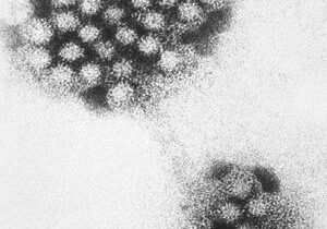 Benton County Health District warns of rising norovirus cases