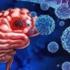 Traces Of Bacteria Found In Brain Tumors