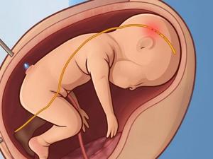 6980c69ca8194imagejpg | Fox 11 Tri Cities Fox 41 Yakima